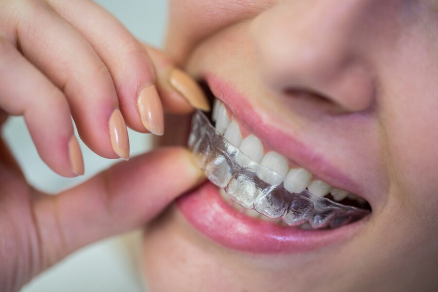 dental care in Raleigh